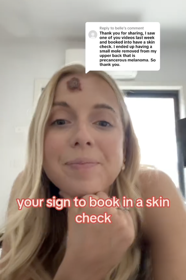 tik tok user with skin cancer